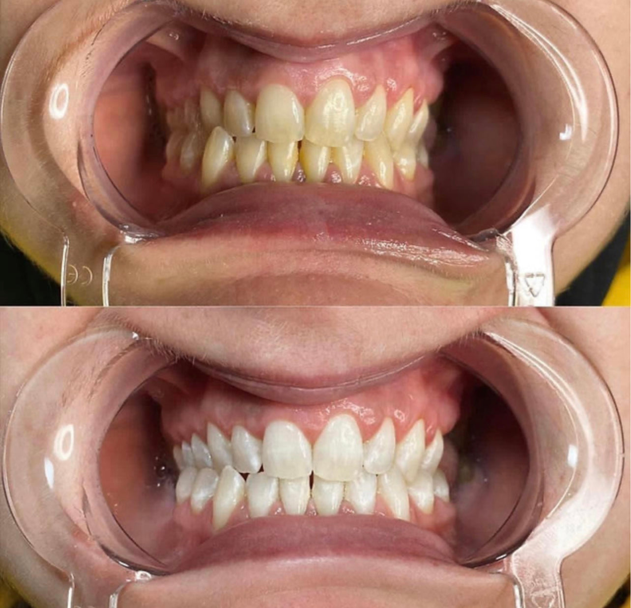 Online Teeth Whitening Training - snatchmebykaoir